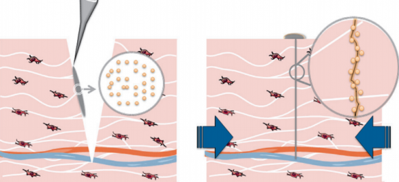 Dibujo20140727 nanobridging wound closure - droplet nanoparticle solution - wiley
