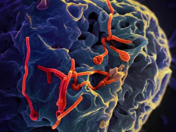 Dibujo20150328 electron micrograph ebola virus surface vero cell - national institute allergy infectious NIAID